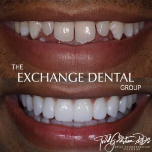 Transformation Three | The Exchange Dental Group