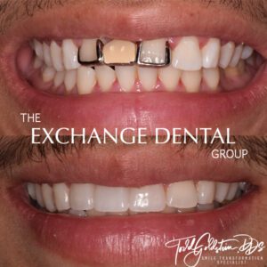 Transformation Two | The Exchange Dental Group